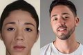Rico Melquíades é barrado em Dubai após fazer harmonização facial