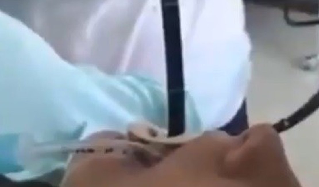 Vídeo. Médicos retiram cobra de estômago de mulher