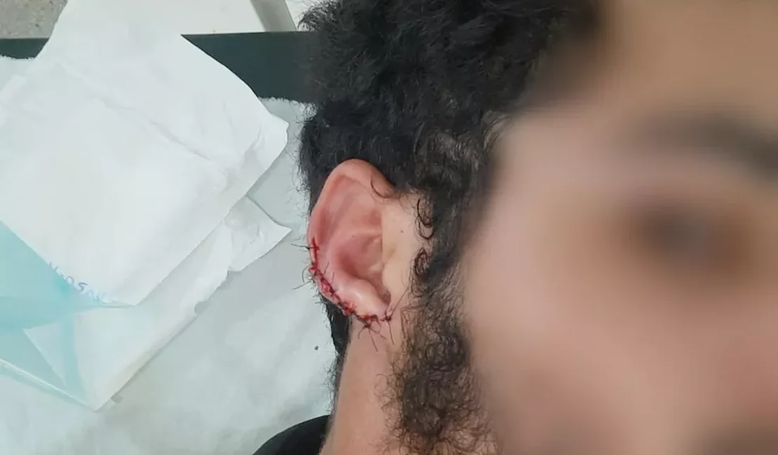 Polícia ouve testemunhas de agressão contra funcionário de lanchonete em São José da Tapera