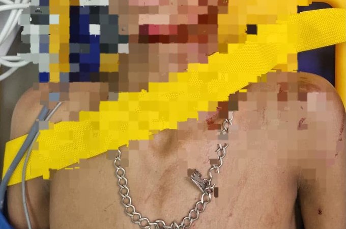 Adolescente de 16 anos é apreendido suspeito de esfaquear jovem no bairro Manoel Teles, em Arapiraca