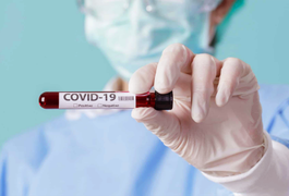 Covid-19: Planos de Saúde são liberados da obrigação de pagar testes sorológico