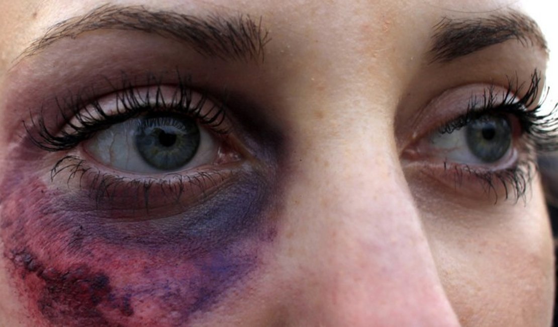 Mulheres vítimas de violência podem fazer cirurgia plástica pelo SUS