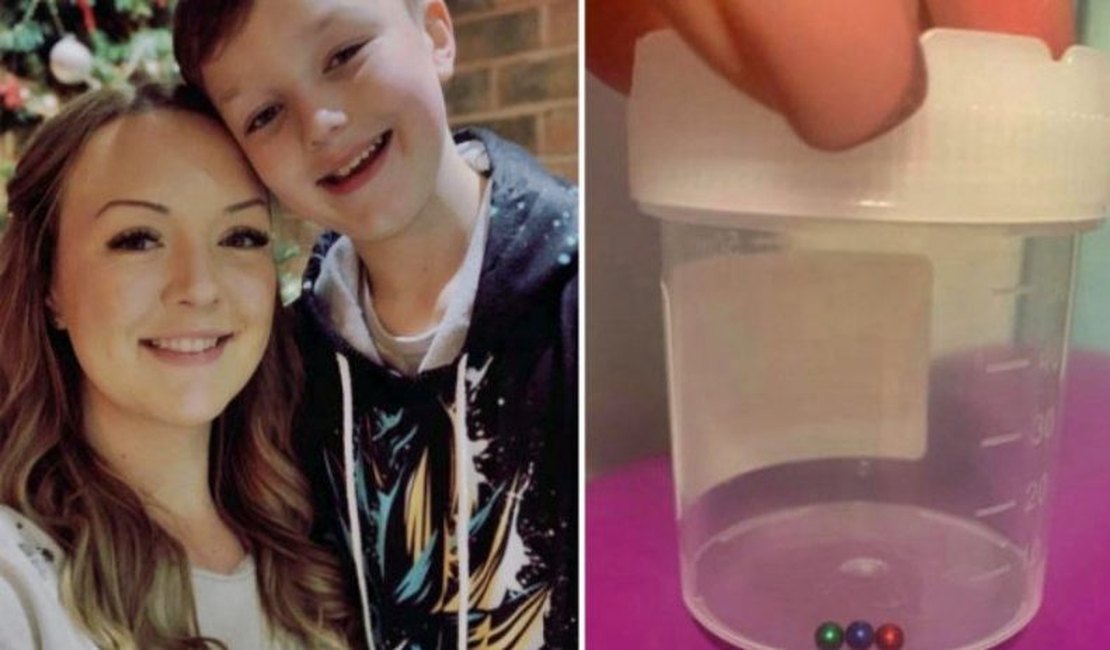 Menino de 11 anos precisa retirar parte do estômago após desafio do TikTok