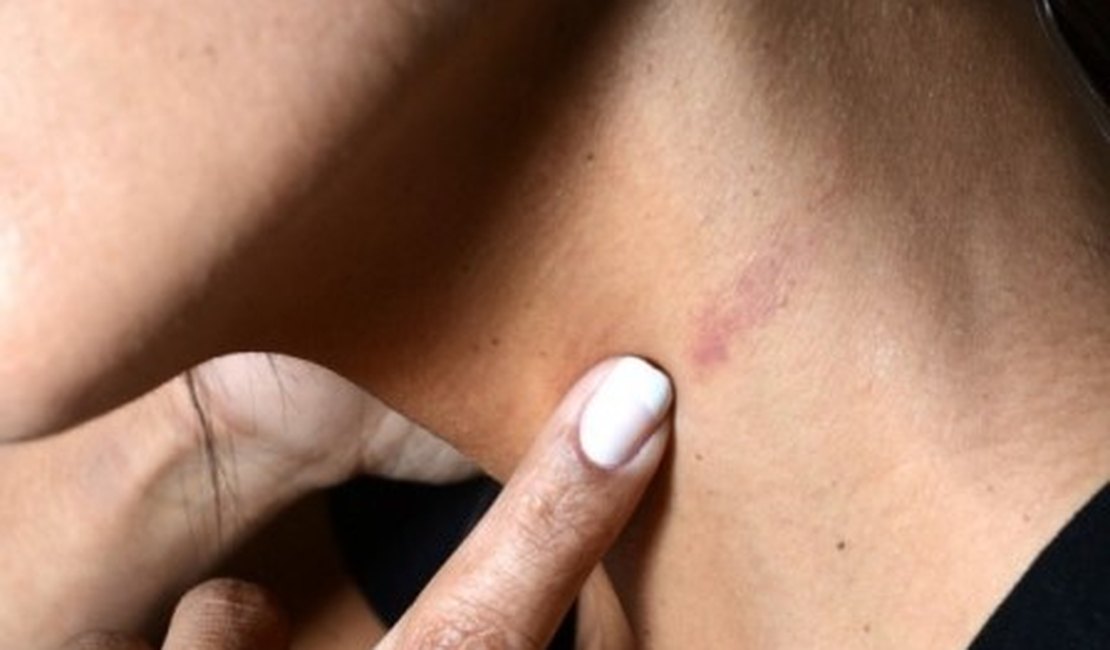 Militar é agredida pelo marido após ler mensagem em celular