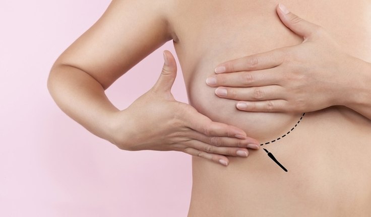 Projeto que garante cirurgia reparadora de mama vai à sanção