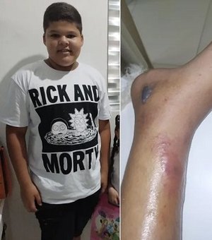 Menino de 12 anos morre após fraturar tornozelo no futebol e família acusa hospitais de negligência: 'dor e revolta'