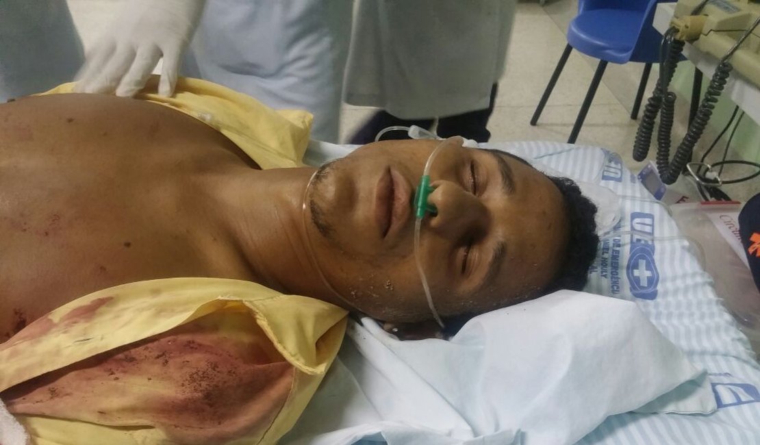 Jovem é alvejado por nove tiros em Teotônio Vilela