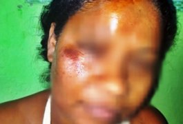 Delegado vai pedir a prisão de homem que agrediu esposa com barra de ferro em Teotônio Vilela