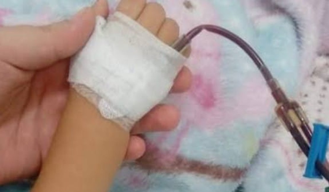 Criança de 4 anos ferida por pitbull é internada no Hospital de Emergência do Agreste