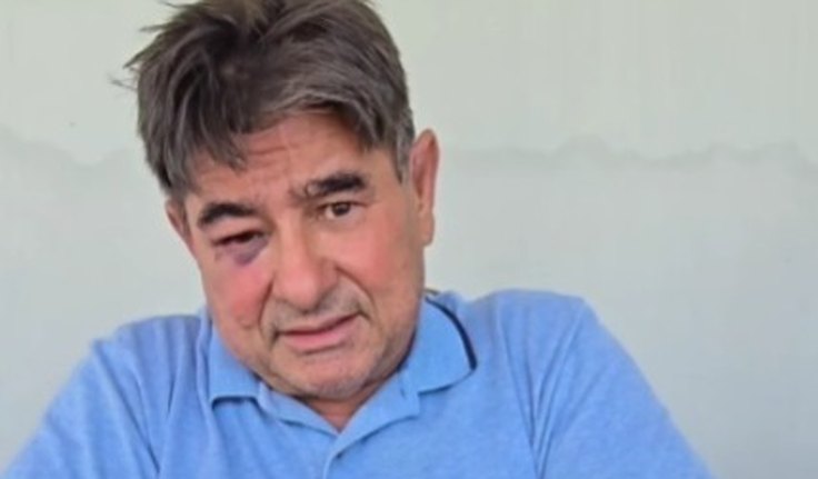 Ex-prefeito de Olivença, Mailson Bulhões se defende de acusação de agressão e afirma ter sido ele a vítima