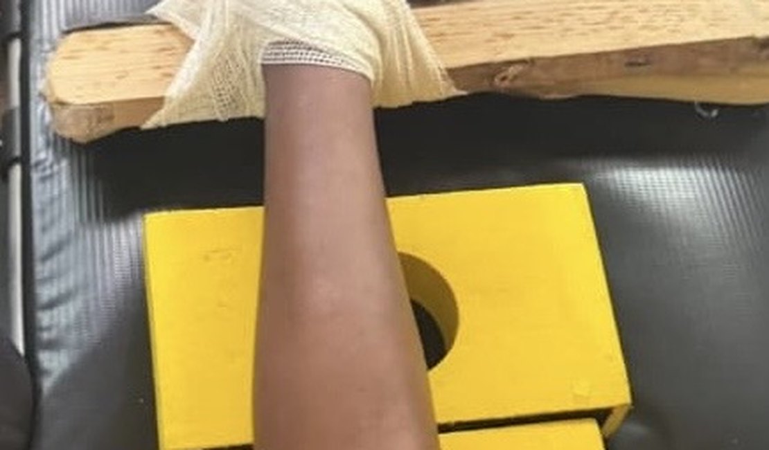 Criança fica com pé preso em objeto perfurocortante e é socorrida pelo Corpo de Bombeiros em Arapiraca