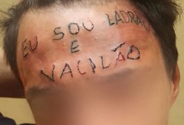 Jovem que teve testa tatuada com frase 'eu sou ladrão e vacilão' é preso após furtar unidade de saúde em Diadema