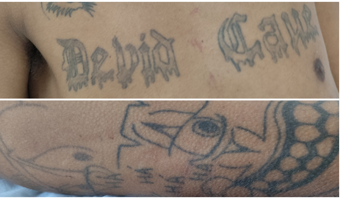 Hospital de Emergência do Agreste procura familiares de paciente identificado apenas como Rafael