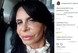 Gretchen faz preenchimento labial e web não perdoa: 'Coringa'
