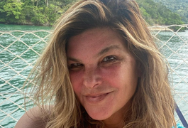 Cristiana Oliveira diz que está ficando 'mais vesga' com a idade e revela anomalia