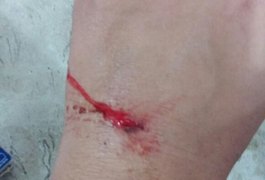 Mulher é atacada por rottweiler dentro de Petshop, em Arapiraca