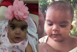 Família pede ajuda para cirurgia de bebê com cardiopatia congênita no interior de AL