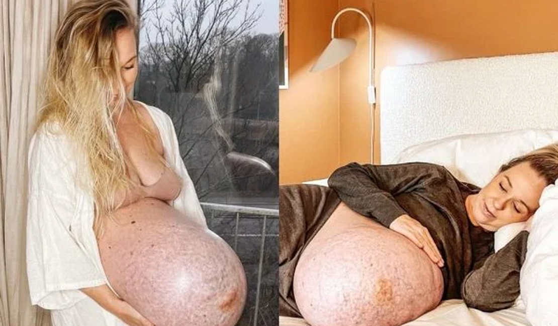 Formato da barriga de influencer grávida chama atenção na web