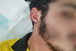 Polícia ouve testemunhas de agressão contra funcionário de lanchonete em São José da Tapera