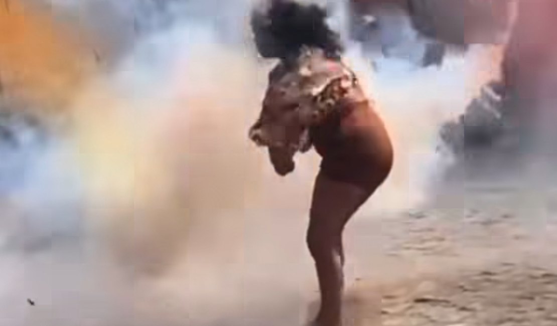 Mulher fica gravemente ferida após ter rosto atingido por espada junina