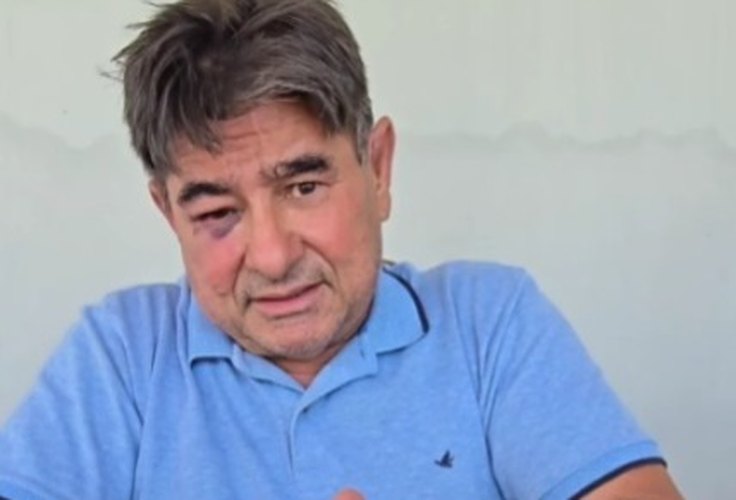 Ex-prefeito de Olivença, Mailson Bulhões se defende de acusação de agressão e afirma ter sido ele a vítima
