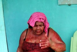 Professora espancada por ex-aluno já está na enfermaria da UE