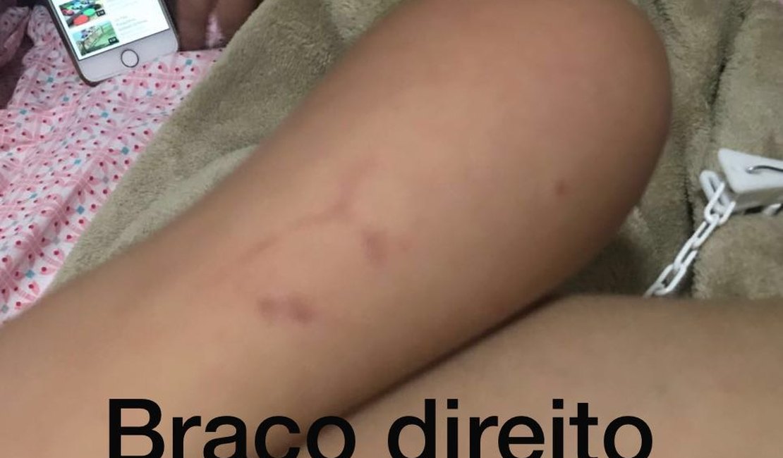 Pais denunciam que criança de dois anos foi agredida na escola por professora
