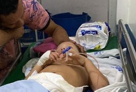 Com ciúmes do marido, madrasta joga criança de seis anos do 4° andar em Maceió