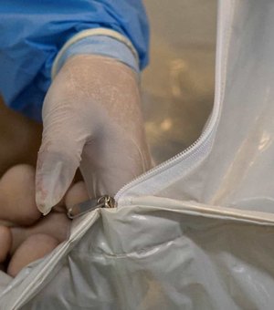 SARS-CoV-2 é detectado em gengivas de pacientes mortos no Brasil; entenda