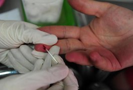 Anvisa libera acesso ao autoteste de HIV