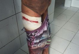 Adolescente suspeito de assalto atira na própria coxa