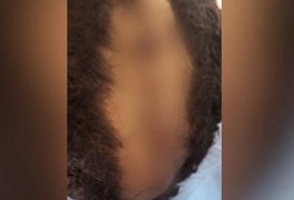 Pai não aceita corte de cabelo do filho de 10 anos e arranca couro cabeludo com faca: “De homossexual”