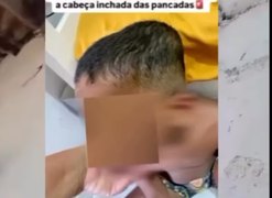 Ministério Público denuncia babá por tortura contra criança autista, em Arapiraca