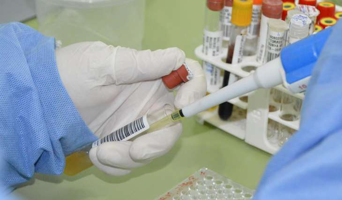 Após investigação, prefeitura descarta 2º caso de meningite B, em União dos Palmares