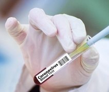 Coronavírus: veja informações sobre o vírus e fuja das Fake News