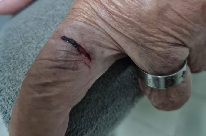 MP denuncia médica e representa filha adolescente por agressão e lesão contra idosa de 77 anos