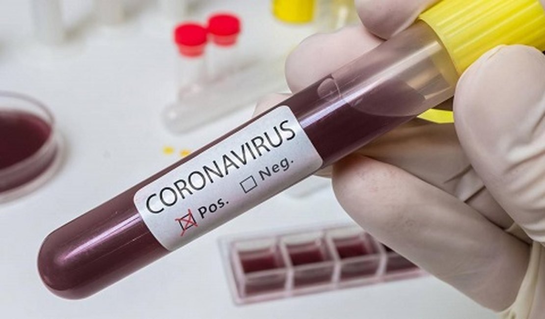 Alagoas registra 2º óbito por coronavírus; casos confirmados saltaram para 23
