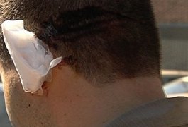Após ameaça, homem arranca pedaço de orelha de desafeto no bairro Boa Vista