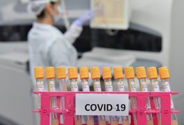 Anvisa vai analisar 1º pedido de registro de vacina contra a Covid