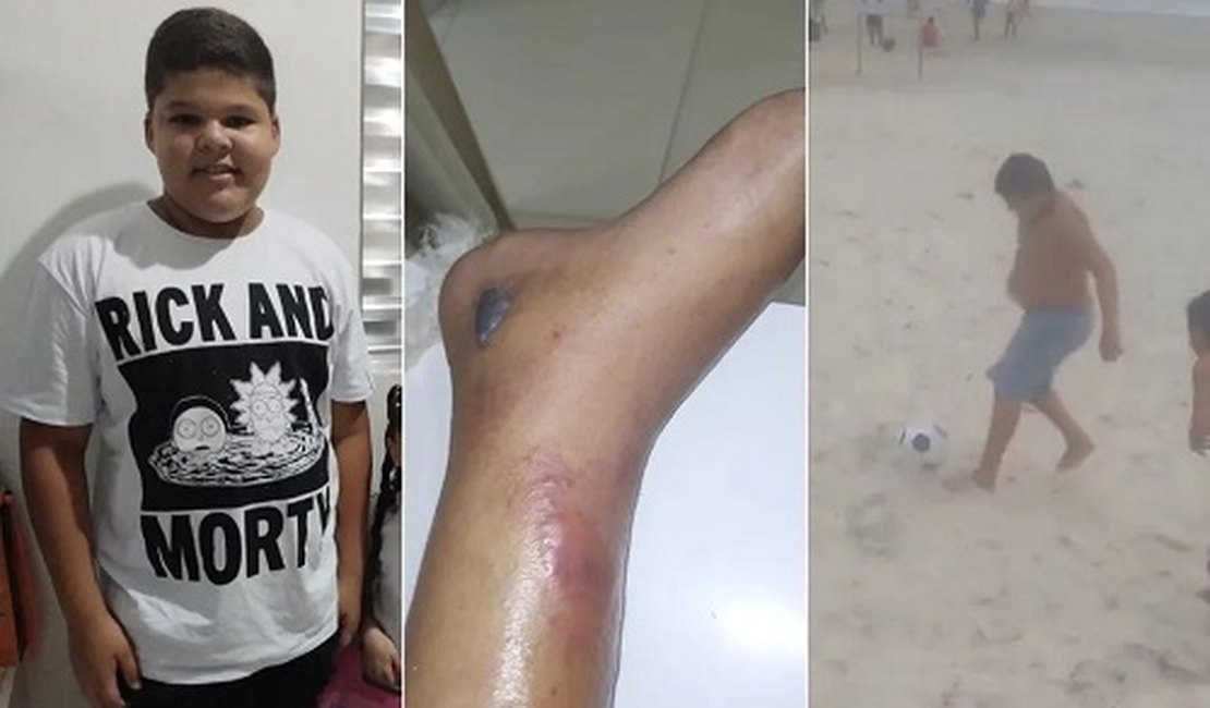 Menino de 12 anos morre após fraturar tornozelo no futebol e família acusa hospitais de negligência: 'dor e revolta'