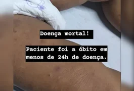 Alagoas já soma 10 casos de meningite e 6 óbitos