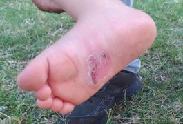 Polícia conclui inquérito e prende casal suspeito de torturar crianças