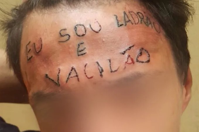 Jovem que teve testa tatuada com frase 'eu sou ladrão e vacilão' é preso após furtar unidade de saúde em Diadema