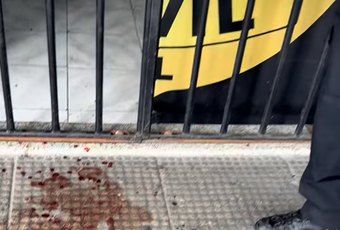 Mulher é agredida pelo companheiro e procura delegacia com mão sangrando em Maceió