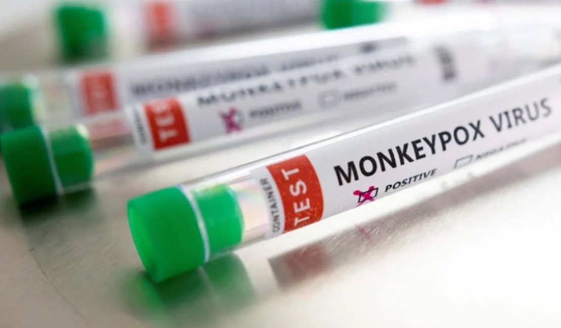 Nariz de homem com varíola dos macacos apodrece antes de diagnóstico