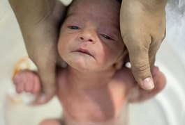 Semana da Amamentação: Hospital Regional de Arapiraca oferece banhos de ofurô para bebês