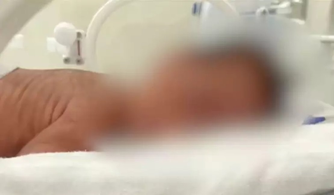 Hospital afasta técnica de enfermagem que aplicou leite ao invés de soro em recém-nascido no RS