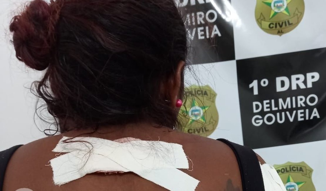 Grávida é atingida por golpes de tesoura após discussão com o companheiro em Delmiro Gouveia