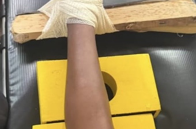 Criança fica com pé preso em objeto perfurocortante e é socorrida pelo Corpo de Bombeiros em Arapiraca