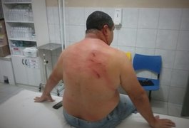 Radialista alagoano é agredido no Agreste de Pernambuco
